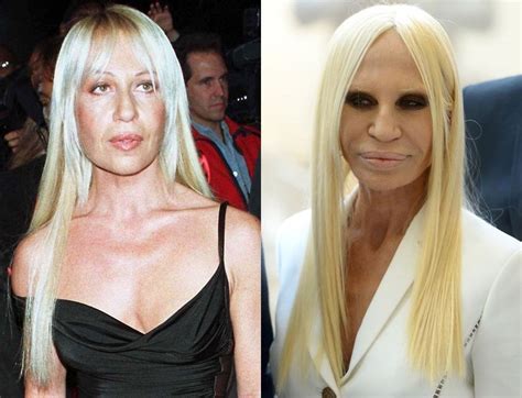 donatella versace op|donatella versace before and after.